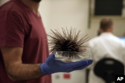 A scientist holds holds a sea urchin specimen of the long-spined Diadema setosum, found in the Mediterranean, at the Steinhardt Museum of Natural History of Tel Aviv University in Tel Aviv, Israel, Wednesday, May 24, 2023. (AP Photo/ Maya Alleruzzo)