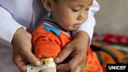 지난 2012년 6월 유니세프 직원이 북한 함경남도 함흥의 한 애육원(고아원)에서 남자 어린이의 팔둘레를 측정하고 있다. 당시 애육원에서 지내는 고아 300명 중 10%가 영양실조 상태인 것으로 파악됐다.
