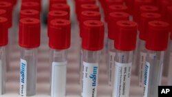 強生公司的子公司比利時楊森製藥公司有關新冠病毒研究的實驗室桌面上擺放的試管。(2020年6月17日)