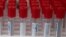 Johnson & Johnson ဓါတ်ခွဲခန်းရှိ စမ်းသပ်မှု ရလဒ်များ