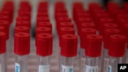 FILE - A case of test tubes is placed on a lab table during research on the coronavirus, at Johnson & Johnson subsidiary Janssen Pharmaceutical in Beerse, Belgium, June 17, 2020. 