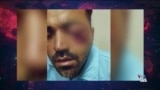 گفت‌و‌گوی صدای آمریکا با فرزاد مرادی‌نیا، زندانی سیاسی پیشین و معترض آسیب‌دیده