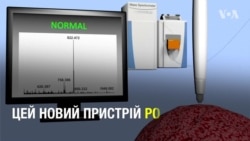 MassSpec Pen може за секунди виявити рак з точністю до 96%. Відео