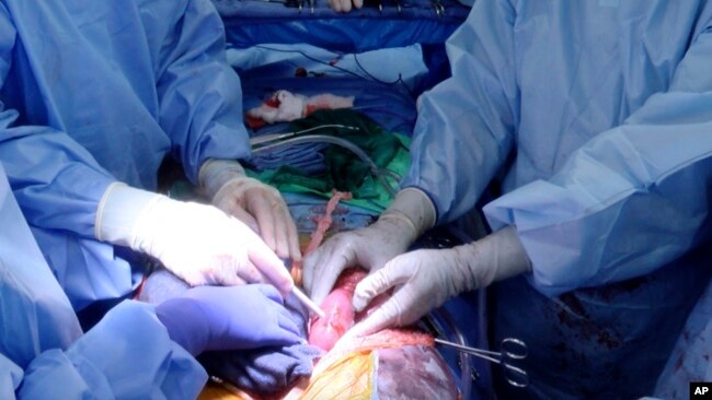 In this photo provided by the University of Alabama at Birmingham, surgeons check whether kidneys from a genetically modified pig are working in the body of a deceased recipient in September 2021. (UAB via AP)