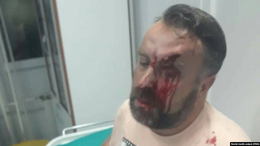 Novinar Stefan Cvetković, fotografija koju je priložio za medije, tvrdeći da je pretučen, Foto: Glas Amerike