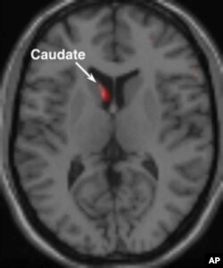 The caudate nucleus portion of the brain, which is associated with passion, becomes aroused when someone is shown a picture of a person with whom he or she is in love.