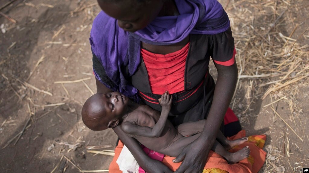 Adel Bol, 20, cradles as she her 10-month-old daughter Akir Mayen at a food distribution site in Malualkuel in the Northern Bahr el Ghazal region of South Sudan.