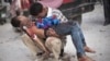'시리아 내전 사망자 47만명'...소두증 태아 뇌서 지카 바이러스 검출
