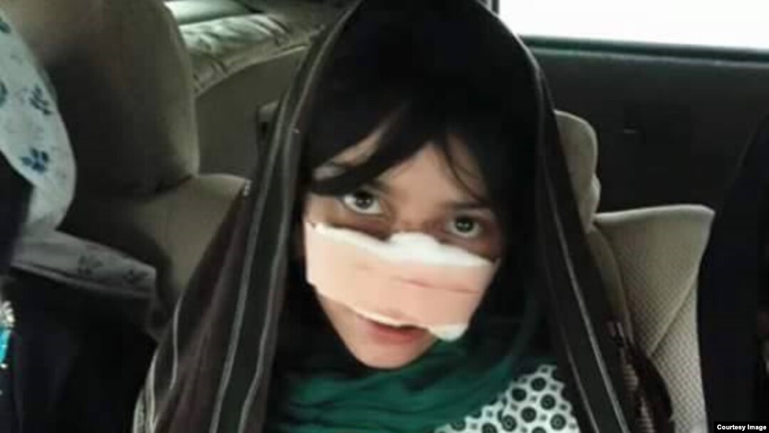 بینی ریزه گل توسط شوهرش بریده شد.