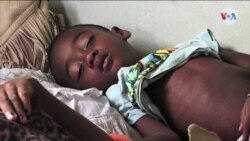 Sarampión: se expande en el mundo