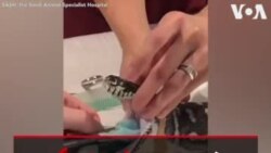 خروج حوله بزرگ از دهان مار ۱۸ ساله