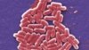 First Drug-resistant Bacteria Case in US Is Not First in World 