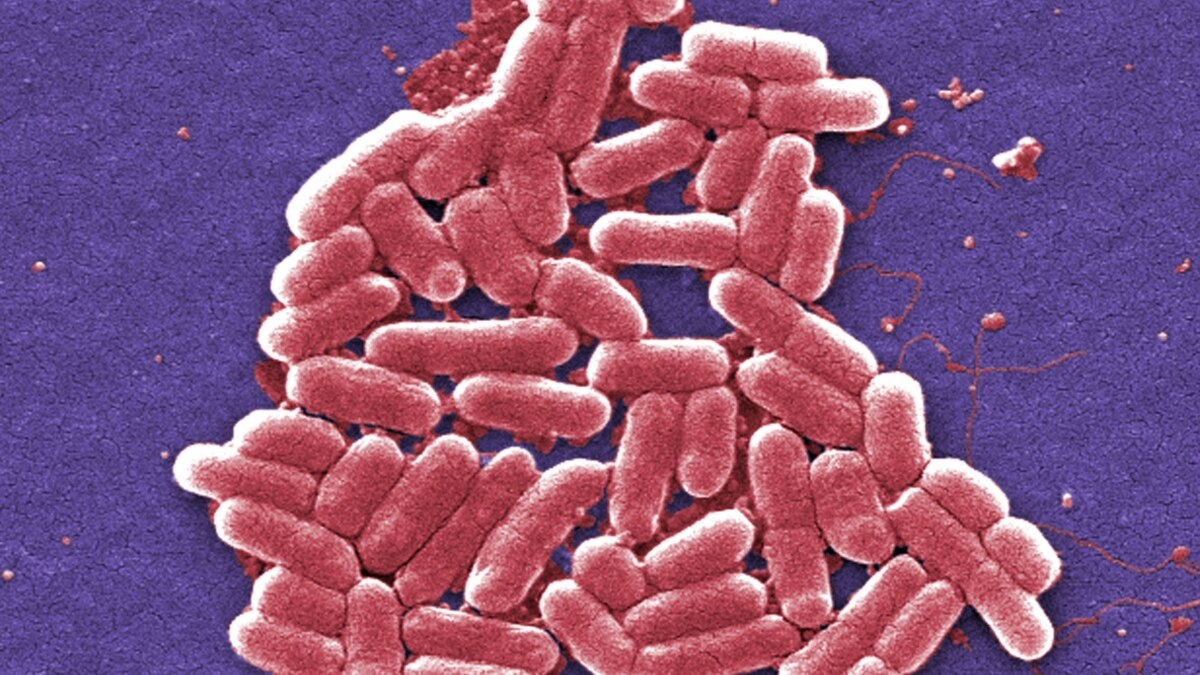 First Drugresistant Bacteria Case in US Is Not First in World