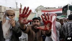 An anti-government protester holds out his blood-stained hands after clashes with security forces, in Sanaa, Yemen, September 18, 2011.