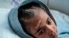 Arsema Berha, de nove anos de idade, ferida, recebe assistência num hispital, 25 Fevereiro 2021
