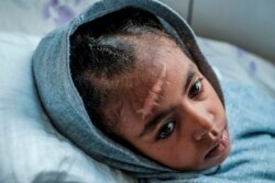 Arsema Berha, umri miaka 9, akiwa katika hospitali ya rufaa ya Ayder mji mkuu waTigray, Mekele, Februari 25, 2021, baada ya kuumizwa katika vita iliyozuka Tigray.