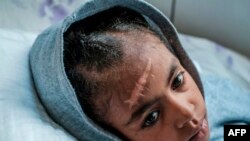 Arsema Berha, de nove anos de idade, ferida, recebe assistência num hispital, 25 Fevereiro 2021