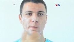 Acné puede ser afectado por vitamina B-12