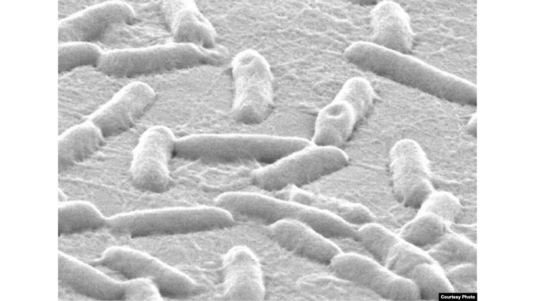 The research targeted Pseudomonas aeruginosa, which causes infection in the lungs, urinary tract, wounds and elsewhere. (Singh Lab, University of Washington)