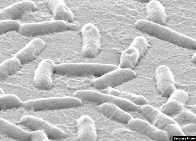 The research targeted Pseudomonas aeruginosa, which causes infection in the lungs, urinary tract, wounds and elsewhere. (Singh Lab, University of Washington)