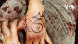 خالکوبی، مد یا نشان دادن مشکلات درونی انسان‌ها