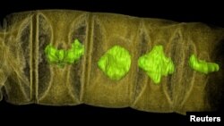 An X-ray tomographic picture of fossil thread-like red algae, tinted to show detail, unearthed in central India may represent the oldest-known plants on Earth, dating from 1.6 billion years ago, according to research published in the journal PLOS Biology. (Courtesy: Stefan Bengtson)