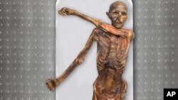 FILE - This photo provided by The South Tyrol Museum of Archaeology shows "Oetzi the Iceman," one of the oldest human glacier mummies. (Marco Samadelli, Gregor Staschitz/South Tyrol Museum of Archaeology/EURAC via AP)