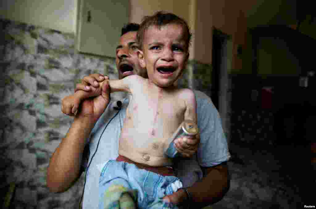 A child seen with an open heart surgery scar cries while holding an empty tear gas canister, which was earlier thrown by riot police, during clashes with residents of the Nile island of al-Warraq.