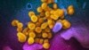 تصویر میکروسکوپی رنگی شده ویروس کرونا (زرد) در حال بیرون آمدن از سطح سلول (آبی و بنفش) را نشان می‌دهد (عکس از مؤسسه ملی بهداشت ایالات متحده/آسوشیتدپرس)