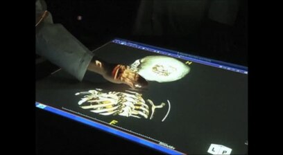 Teknologi Robot di Bidang Kedokteran Gigi