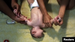 Therapist Rozely Fontoura (L) teaches Daniele Santos Shantala massage on her baby Juan Pedro, who has microcephaly, in Recife, Brazil, March 26, 2016.