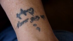 Art shown on the arm of Dana Zzyym that reads "Never give up" October 27, 2021. Zzyym said the art helps them remember goals to carry out in life. (AP Photo/Thomas Peipert)