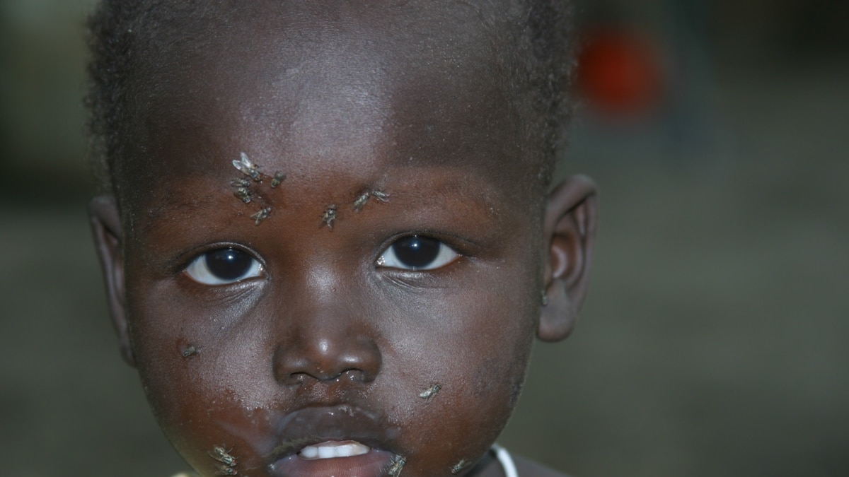 Carter Center Works to Eradicate Trachoma