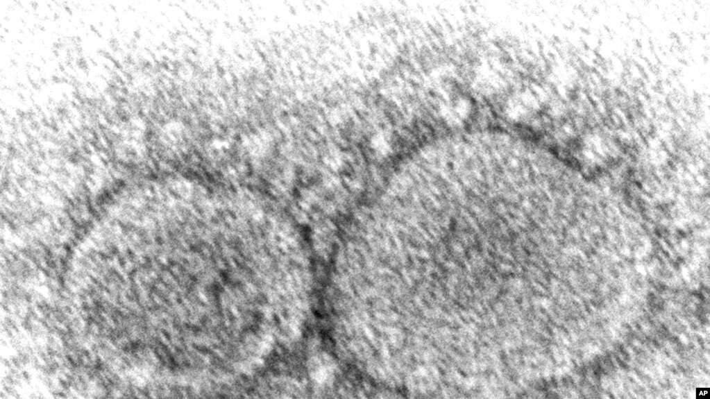 资料照：美国疾病控制与预防中心提供的这张2020年的电子显微镜图像显示了导致COVID-19的SARS-CoV-2病毒颗粒。(photo:VOA)
