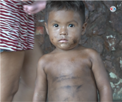 Los niños están entre los más afectados por las humaredas generadas por los fogones a leña.