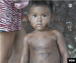 Los niños están entre los más afectados por las humaredas generadas por los fogones a leña.