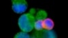Enzym PI-3 Kinase Gamma akan Dikembangkan untuk Obati Kanker