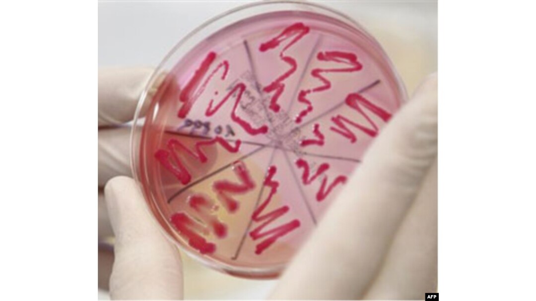 E.coli bakteriyasi