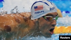 Michael Phelps and other Olympic athletes have small, circular bruises. Where do they come from? They come from something called "cupping."