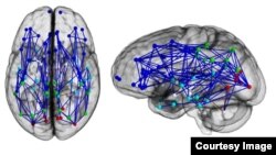 Brain networks show increased connectivity in males and females.(University of Pennsylvania)