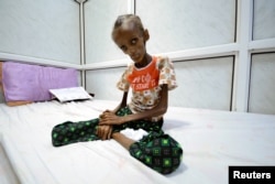Saida Ahmad Baghili, 18, who is affected by severe acute malnutrition, sits on a bed at the al-Thawra hospital in the Red Sea port city of Houdieda, Yemen, Oct. 24, 2016.