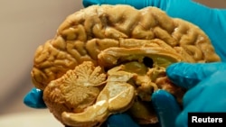 A developing brain can be damaged by unkind words, a study shows. (FILE PHOTO)