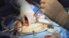 Ilustrasi - Seorang pasien gagal ginjal sedang menjalani transplantasi di sebuah rumah sakit di AS.
