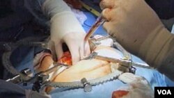 Ilustrasi - Seorang pasien gagal ginjal sedang menjalani transplantasi di sebuah rumah sakit di AS.