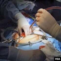Seorang pasien yang gagal ginjal sedang menjalani transplantasi di sebuah rumah sakit di AS, sebagai ilustrasi.