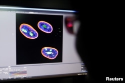 A researcher observes image on a screen showing the nucleus of human stem cells after KAT7 intervention, in the Aging and Regeneration lab at the Institute for Stem Cell and Regeneration of the Chinese Academy of Sciences (CAS) in Beijing, China.