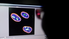 A researcher observes image on a screen showing the nucleus of human stem cells after KAT7 intervention, in the Aging and Regeneration lab at the Institute for Stem Cell and Regeneration of the Chinese Academy of Sciences (CAS) in Beijing, China.