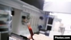 A technician holds a vile of blood drawn for testing. Cardiovascular and respiratory diseases, diabetes, and cancers are rise in developing countries.