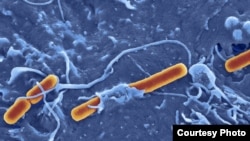 Bakteri Shigella Sonsei penyebab disentri. (Foto: Dave Goulding)