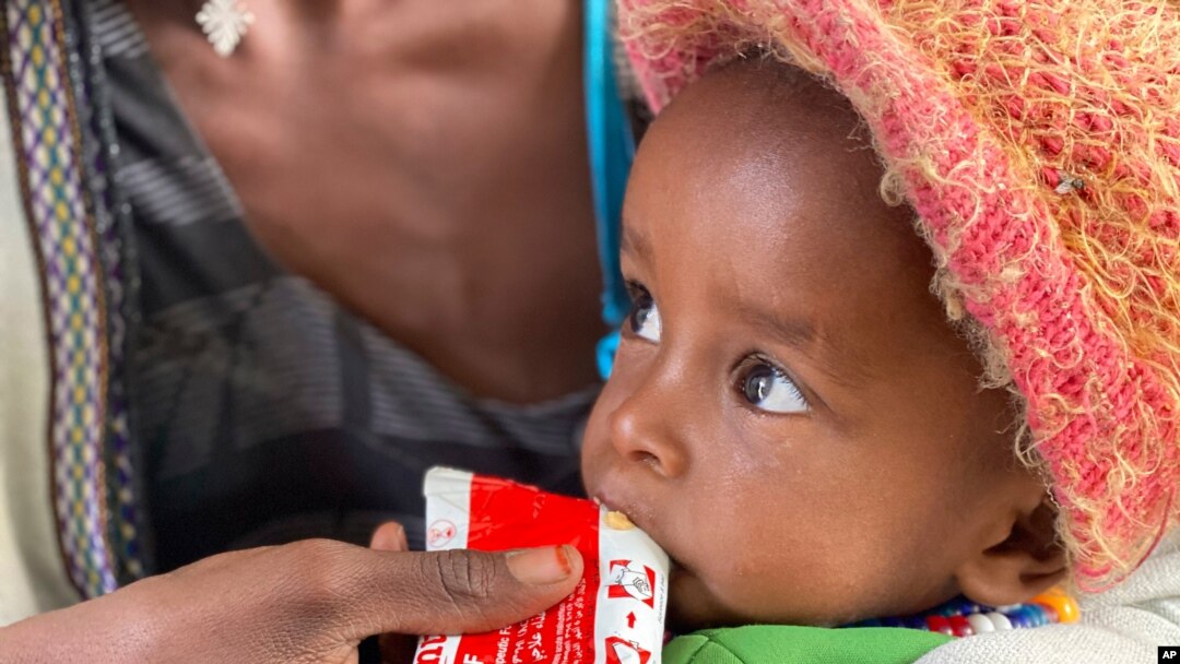 FILE - A child held by his mother eats emergency food after being screened for malnutrition in Debub Health Centre in Wajirat woreda in Southern Tigray in Ethiopia, July 19, 2021.